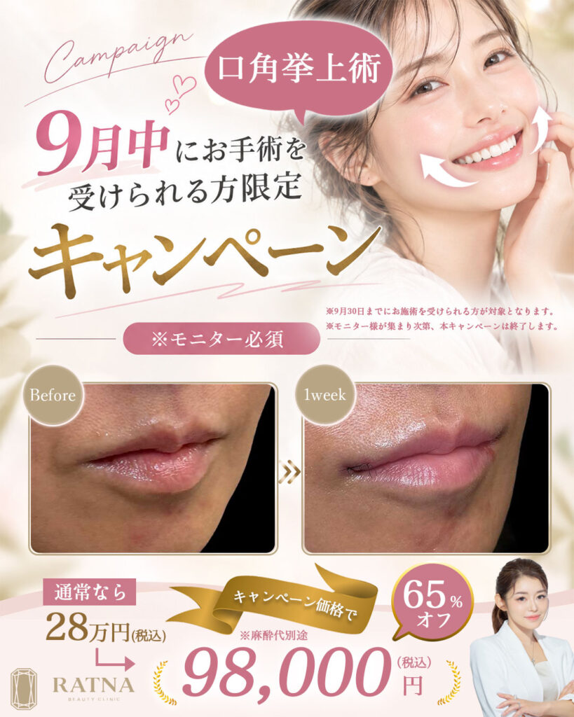 【9月限定】口角挙上術スペシャルキャンペーンのご案内